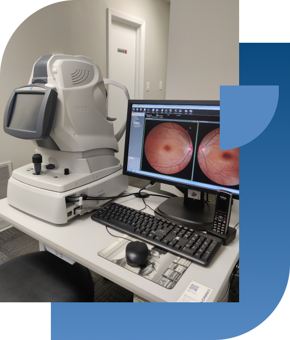 Retinal Imaging With Retinal Photography to detect and monitor eye diseases in Whitby, Ontario