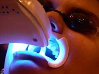 RevitalWave offers quick and painless Teeth Whitening for a confident smile in Long Island, NY