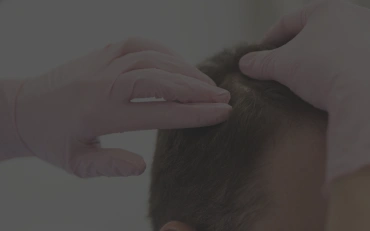 Revitalize your Hair with tailored Treatments for Men at Lanka Salon & Spa in Brampton, Mississauga