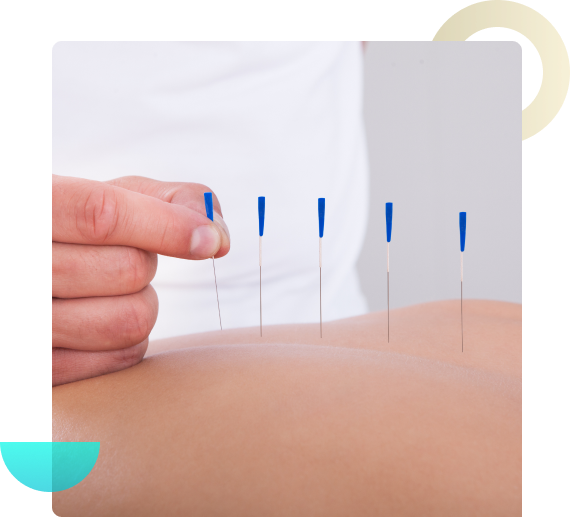 Dive into the intricacies of Medical Neuro-Acupuncture with our comprehensive diploma courses