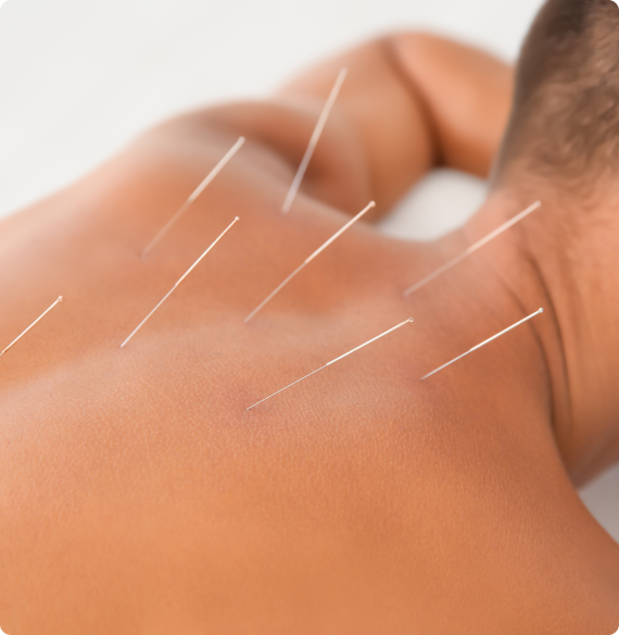 Unlock the world of Traditional Chinese Medicine with our TCM Acupuncture Diploma Program