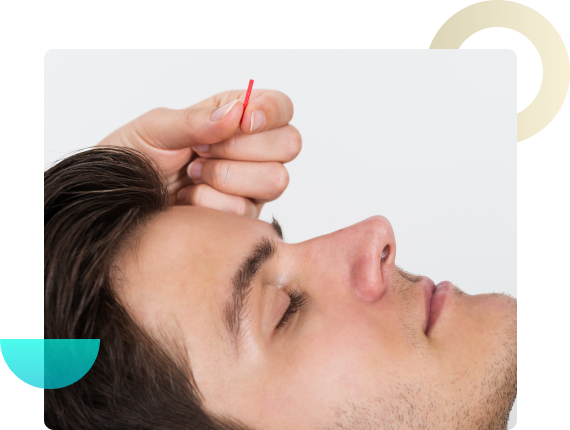 Experience excellence with our specialized Cosmetic Acupuncture Course in Burlington