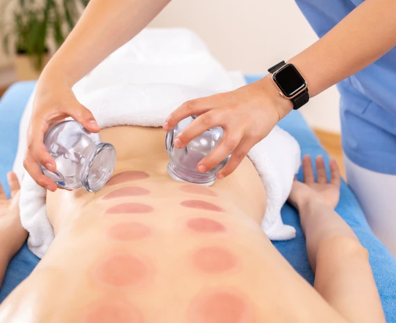 Revitalize your wellness with Acupuncture & Healing Center Cupping Therapy in Manassas