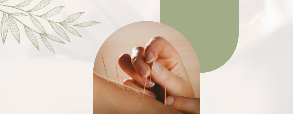 Experience renewed well-being with Acupuncture & Healing Center Acupuncture Treatment in Manassas