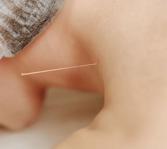 The Acupuncture & Healing Centre in Ashburn attentively provides Acupuncture therapy for holistic well-being