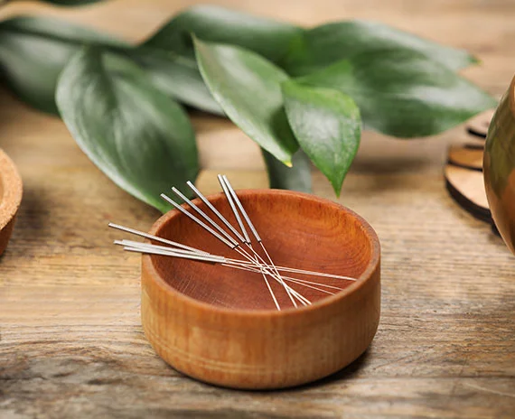 Discover the healing power of Acupuncture at the Acupuncture & Healing Center in Manassas