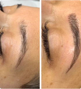 Blix Clinical Aesthetics & Laser in Seattle offers Lash Tinting to enhance your eyelashes