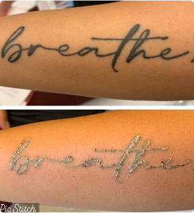 We are dedicated to achieving exceptional results through our precision Tattoo Removal services