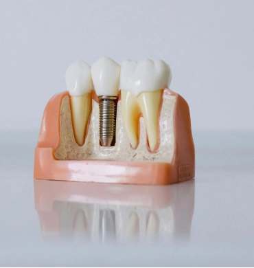 Dental Services Toronto