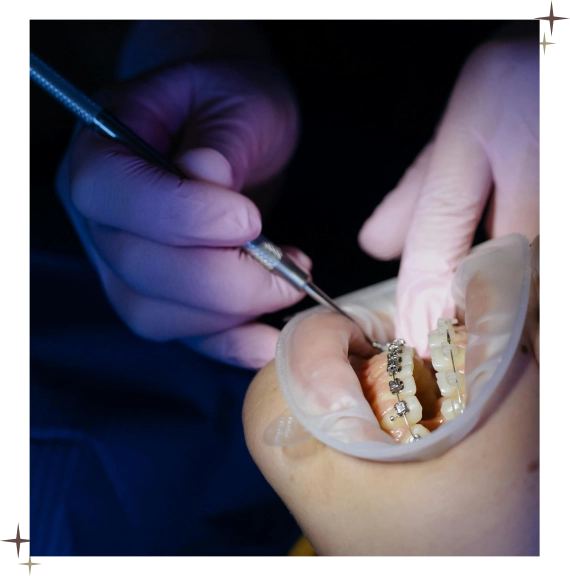 Orthodontic Treatment North York On