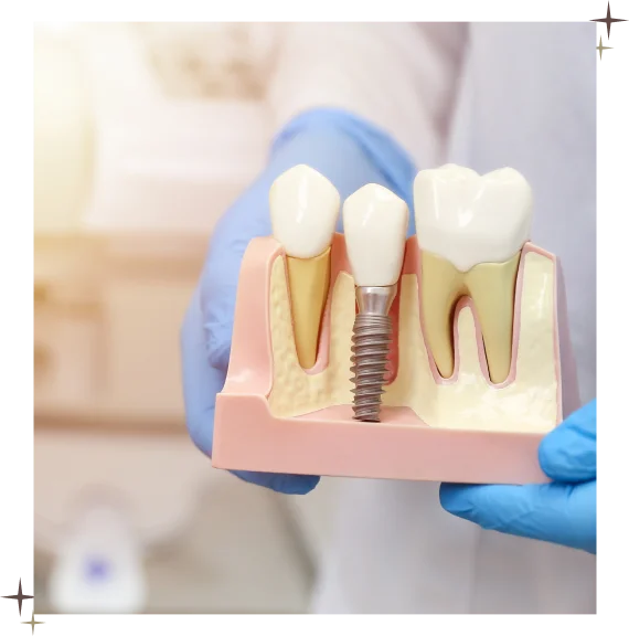 Dentures North York
