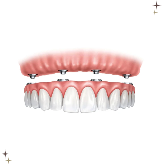Restorative Dental Care