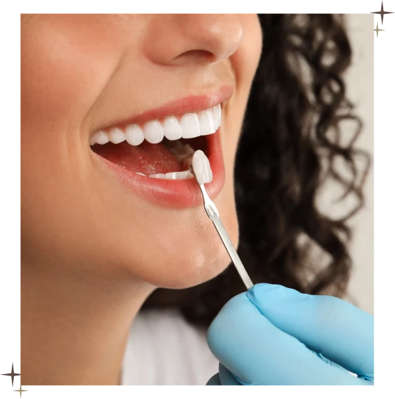 Dental Crowns in North York