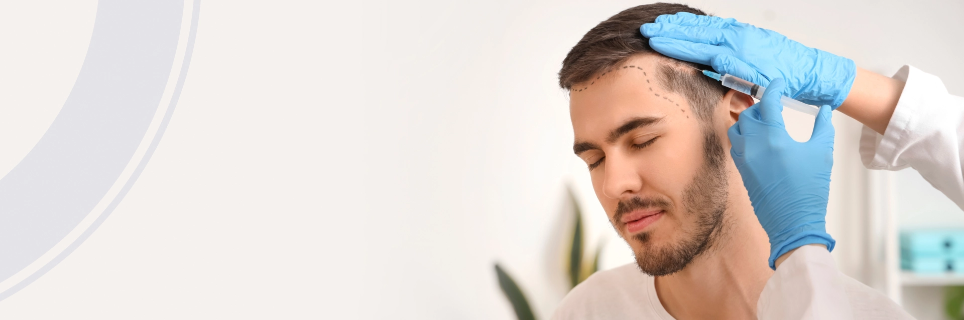 Hair Transplant San Francisco Bay Area