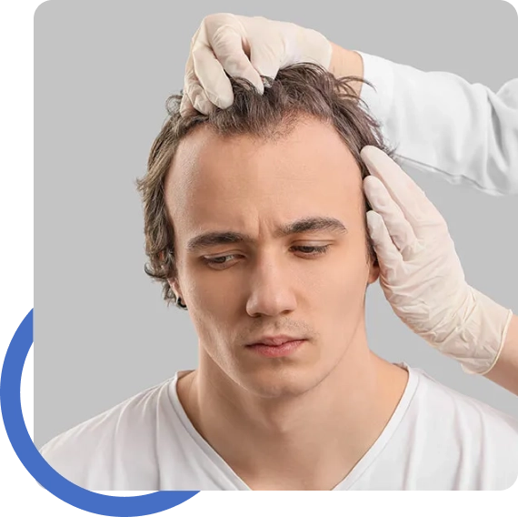 Hair Restoration San Francisco Bay Area