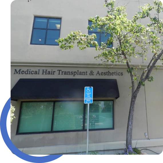 Hair Restoration San Francisco Bay Area