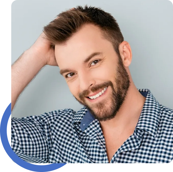 Beard Transplant Bay Area