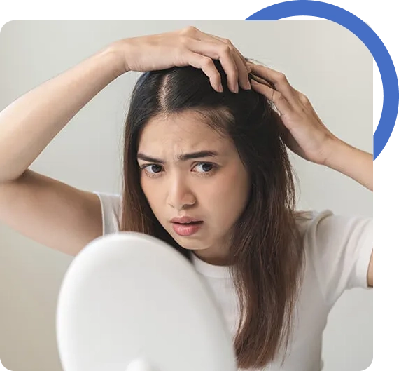 Hair Transplant For Females