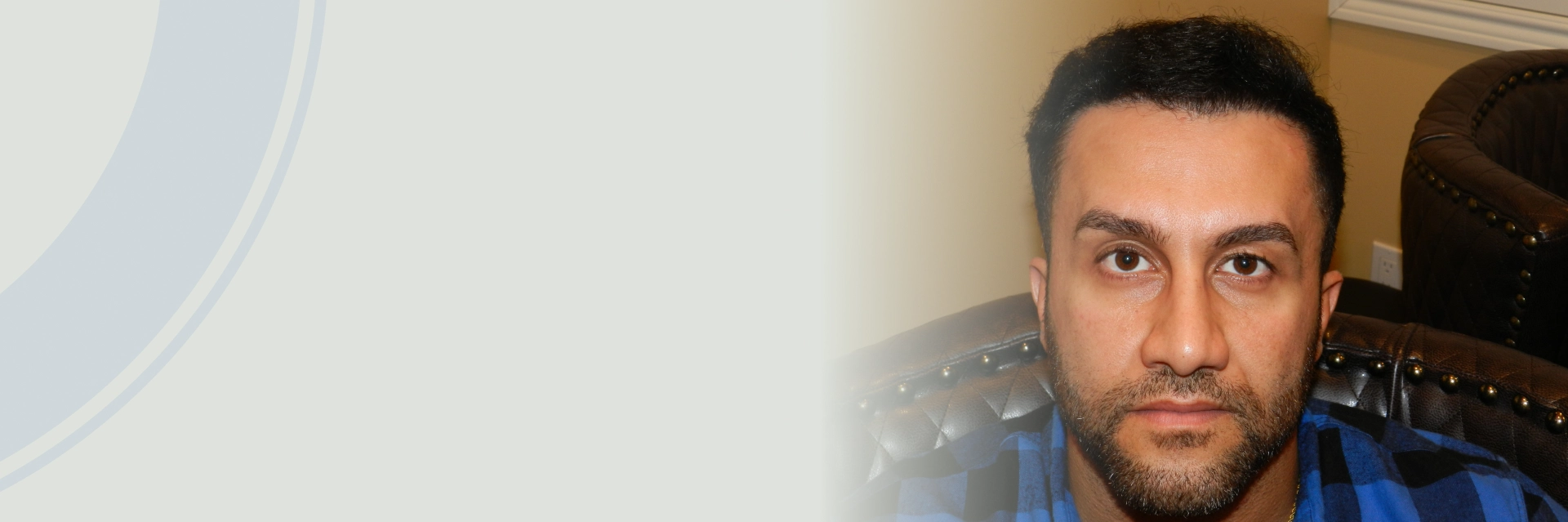 Hairline Restoration Surgery