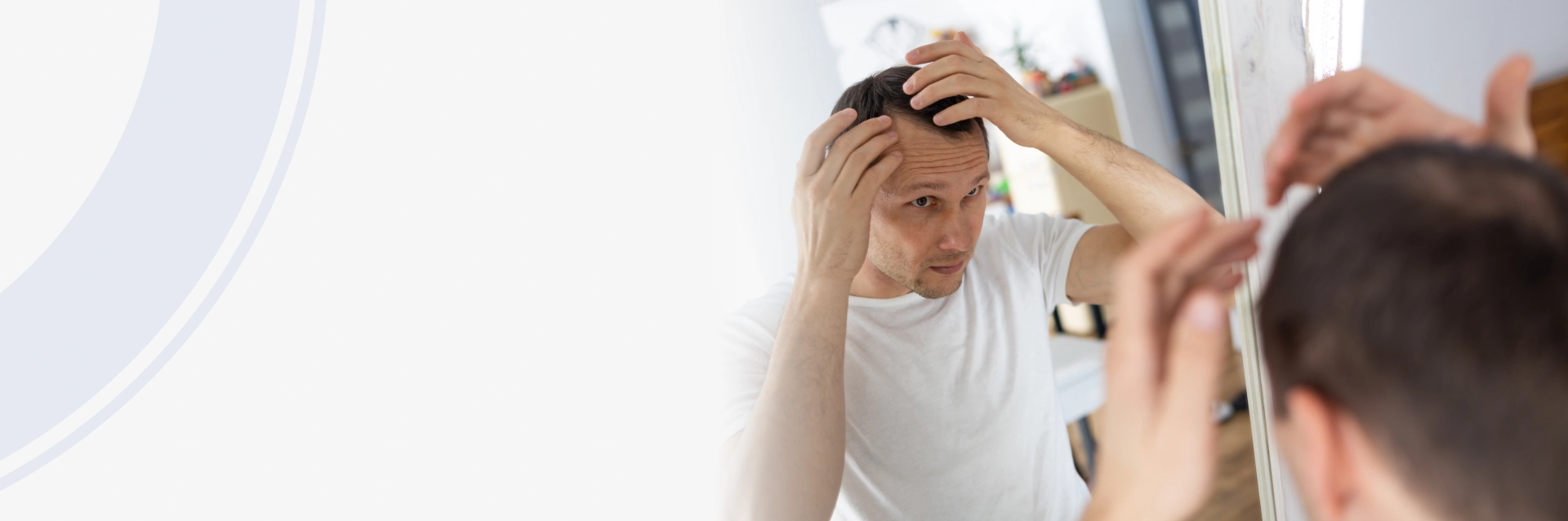 Hair Transplant San Francisco Bay Area