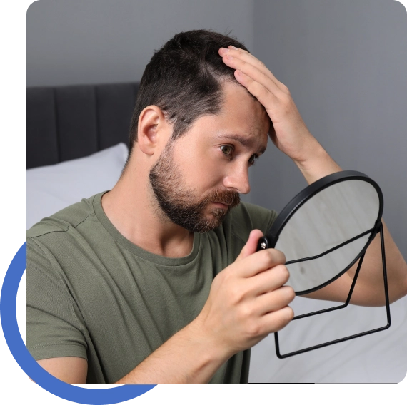 Hair Transplant Monterey