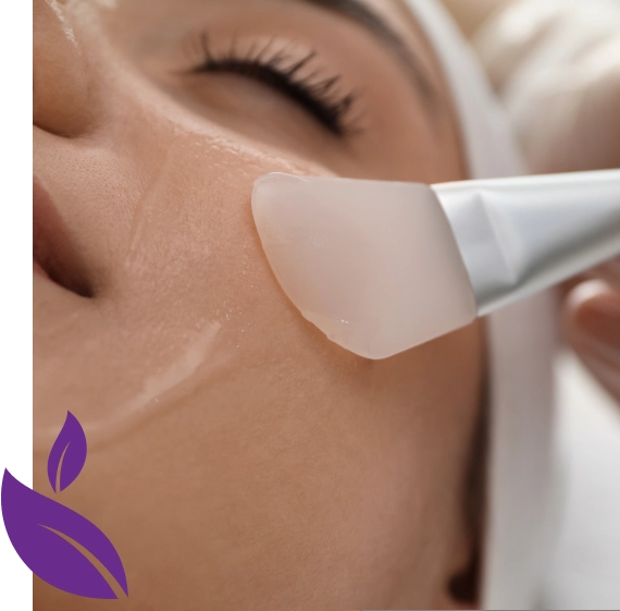Chemical Face Peels