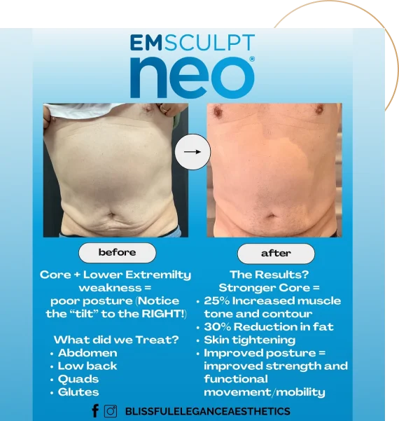Enhance Your Functional Wellness with Emsculpt Neo