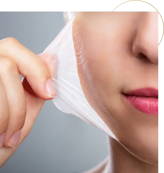 Our Facials and Chemical Peels