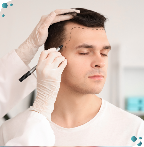 exosome hair regrowth