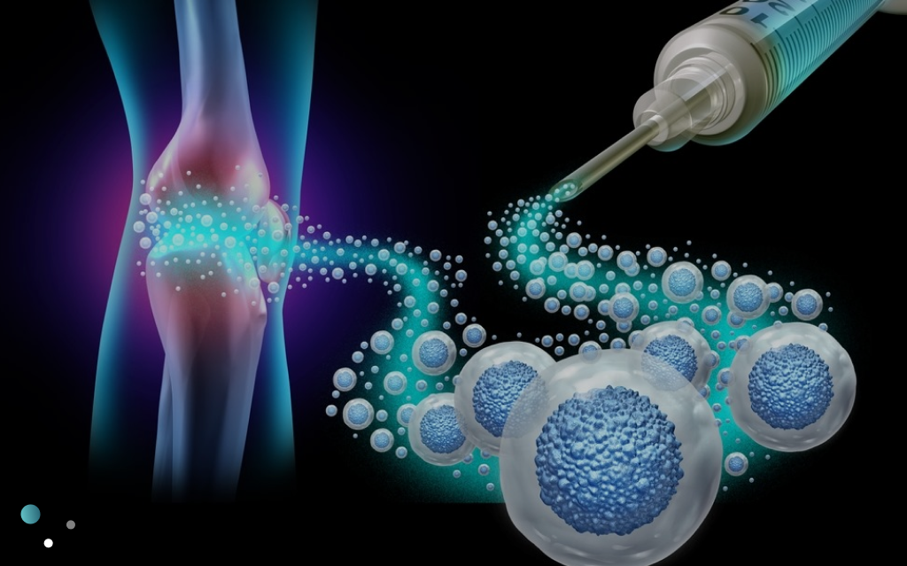 Stem Cell Therapy