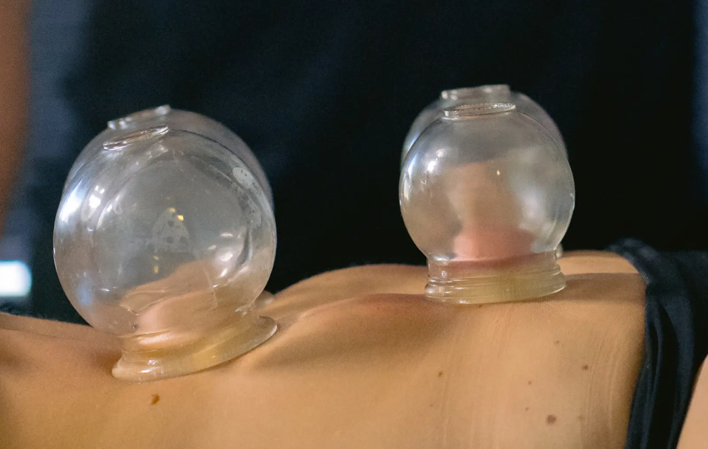 Professional acupuncture care in San Diego for active adults