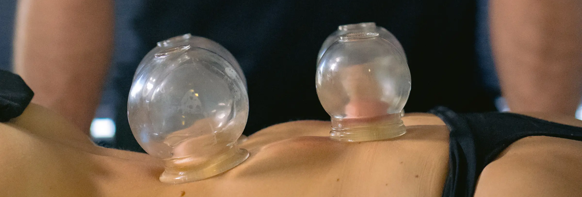 Professional acupuncture care in San Diego for active adults
