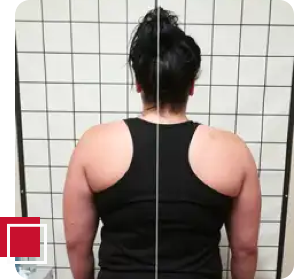 Myofascial therapy for pain relief session
