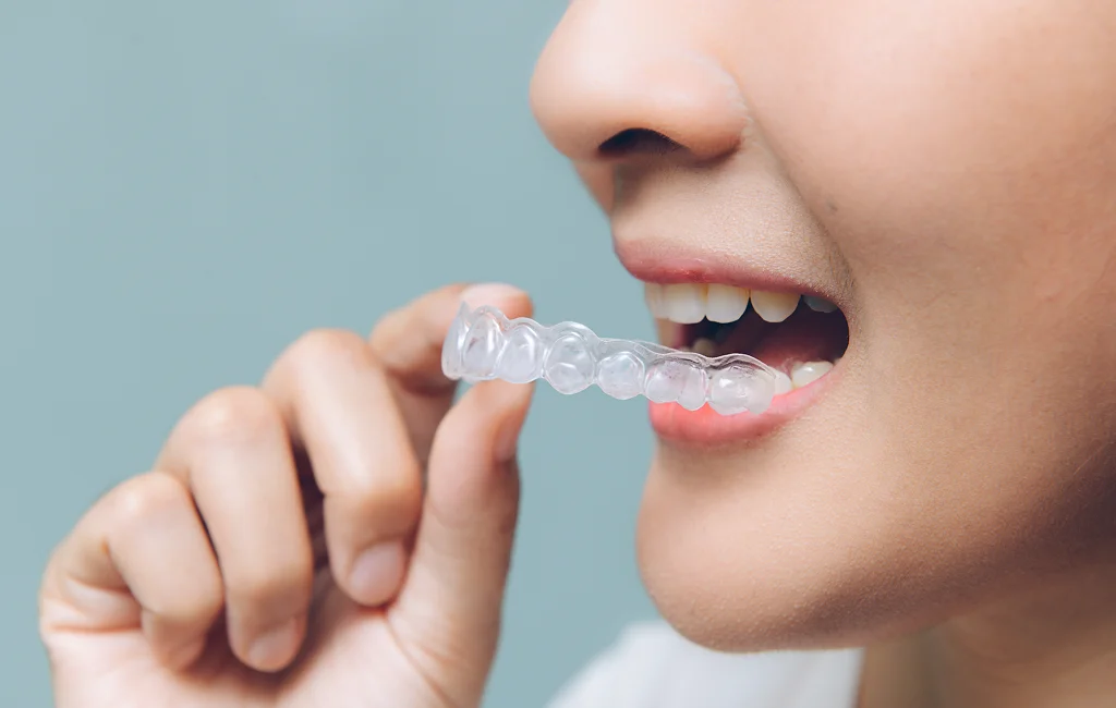 Orthodontic Dental Care Services​