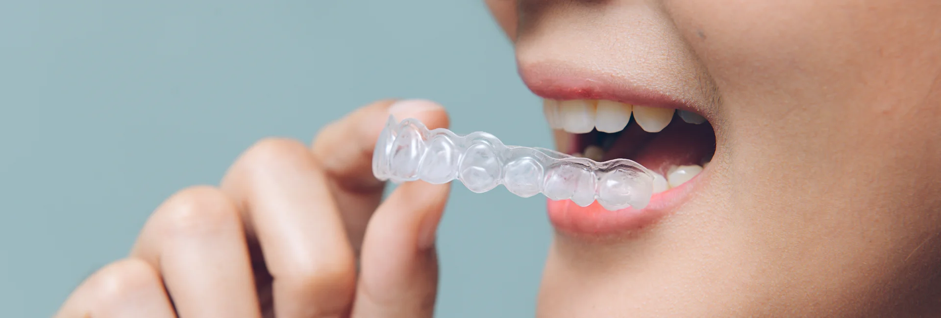 Orthodontic Dental Care Services​