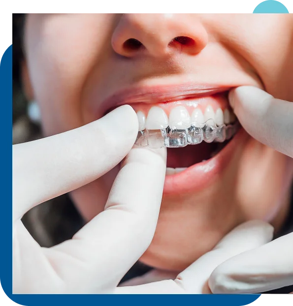 Regular Growth Monitoring