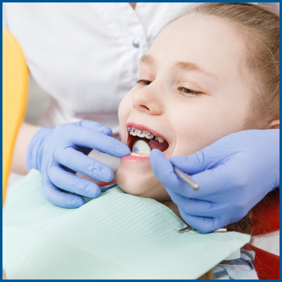 Early Orthodontic Treatment