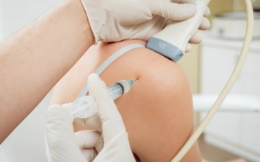 Ultrasound Guided Injection