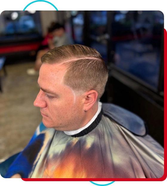 scalp micropigmentation cost