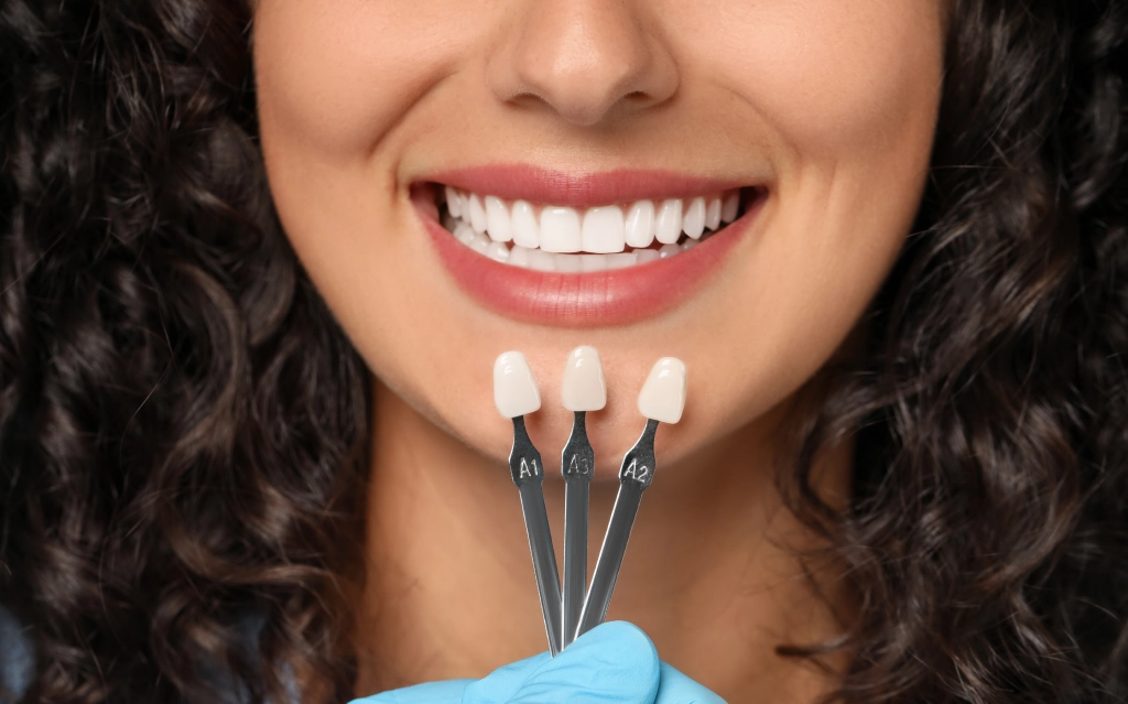 Cosmetic Dentistry Pearland