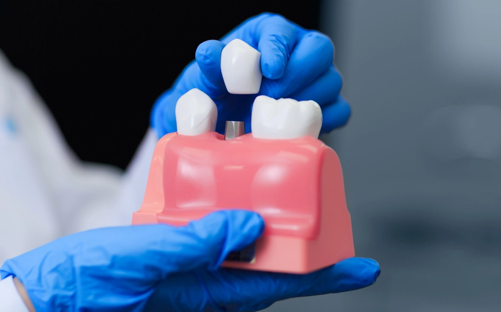 Restorative Dentistry Pearland