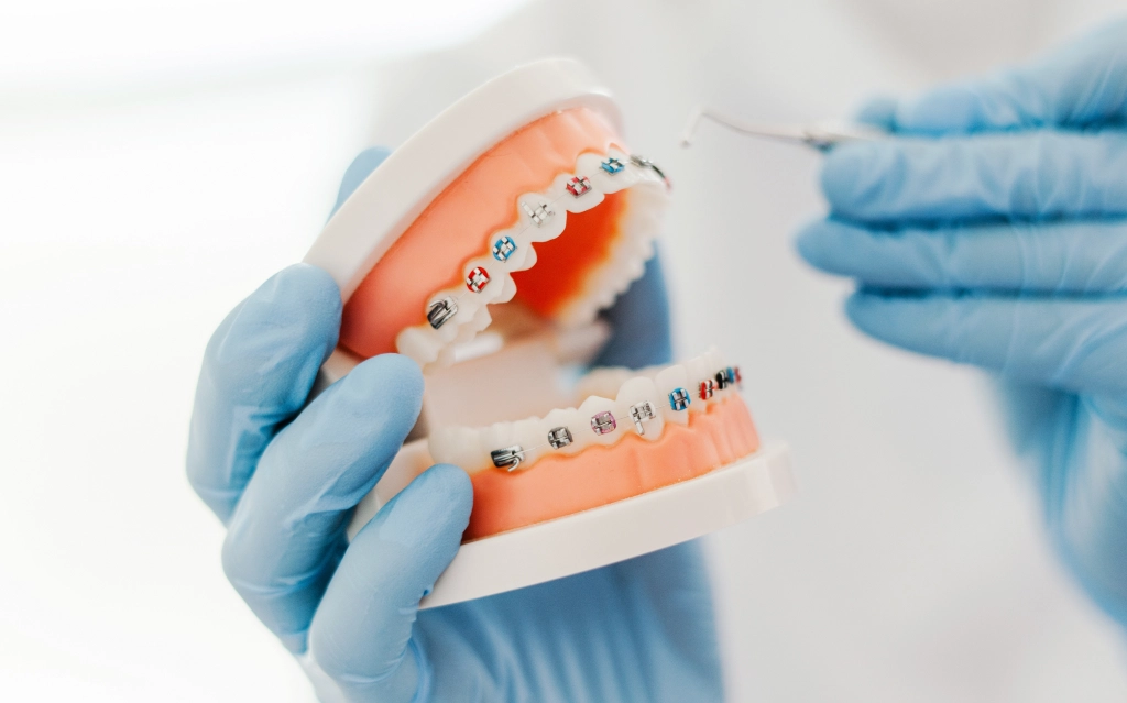 Orthodontics Pearland