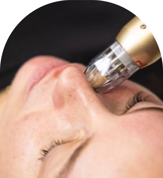What Are Injections & Microneedling