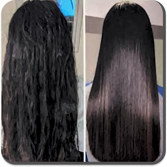 Scalp Rejuvenation Therapy