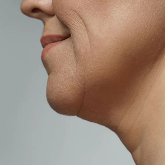 Jawline and Neck Definition