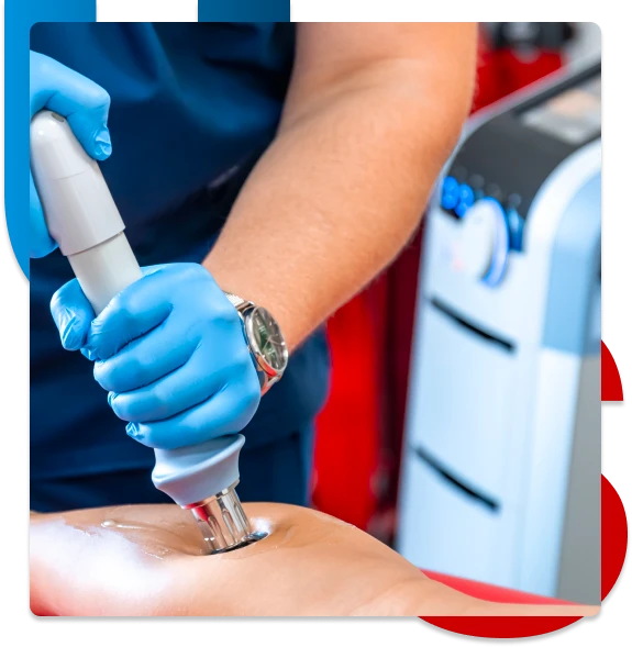Shockwave Therapy For Pain Relief