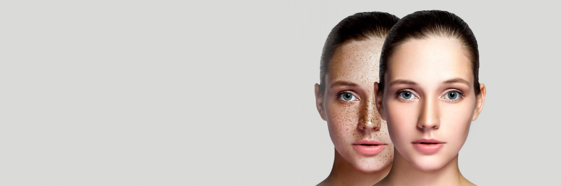 Pigmentation Removal Services Cedar Park
