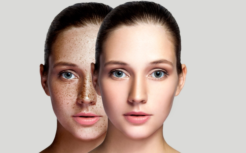 Pigmentation Removal Services Cedar Park