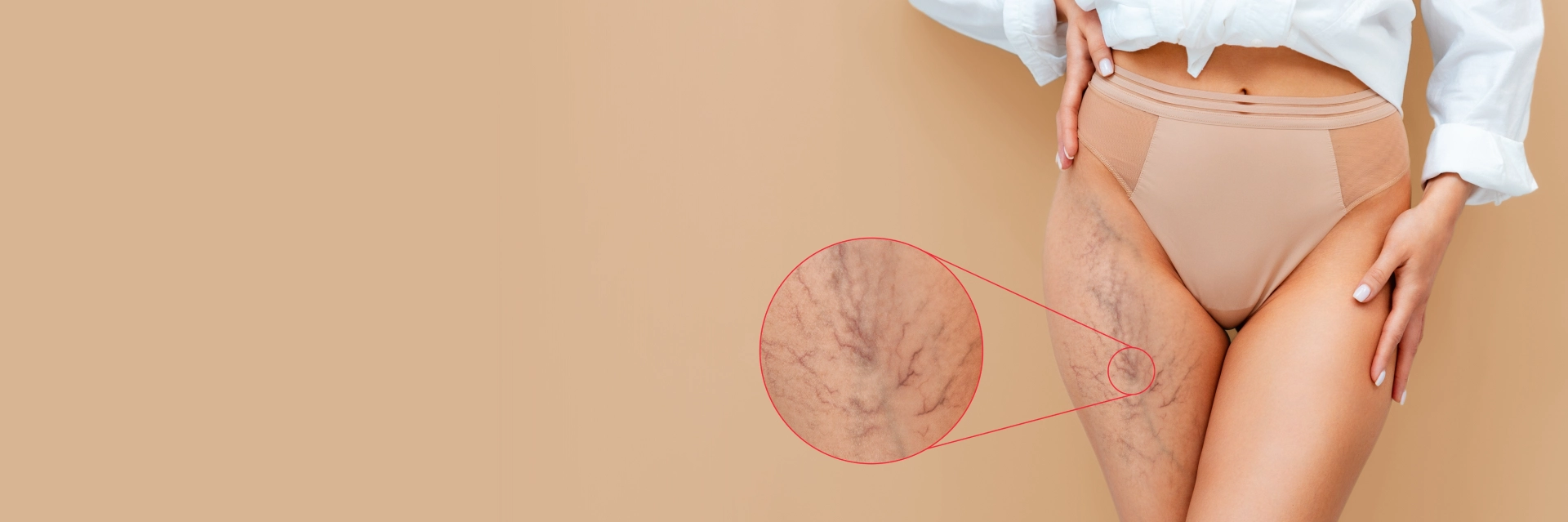 Vascular Lesions Treatment Services Cedar Park