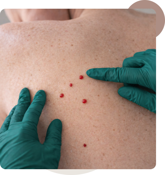 Comprehensive Consult and Treatment Plan